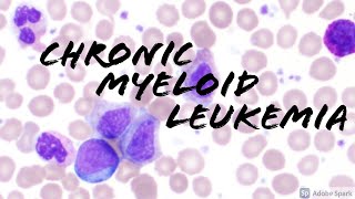 Chronic Myeloid Leukemia CML Peripheral Blood Smear Hematopathology amp Hematology [upl. by Nawad890]