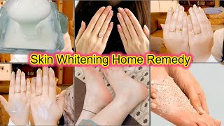 Skin Whitening Home Remedy l Remove Pigmentation Dark Spots pimples  Hand feet whitening cream [upl. by Eynttirb]