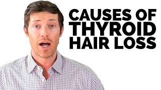 These 4 Things Cause Thyroid Hair Loss [upl. by Larkin303]