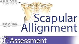 Scapular Alignment and possible causes for dyskinesia [upl. by Cogen]