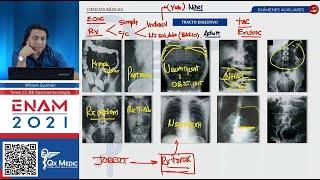 DIGESTIVO Exámenes auxiliares ENAM 2021 [upl. by Eolc]