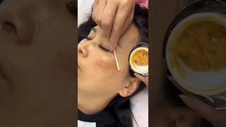 dark spots on face removal shorts skin beautytips [upl. by Aisayt767]