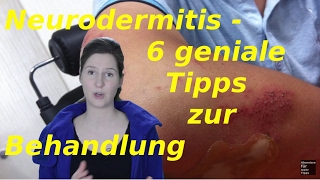 Neurodermitis Gesicht  6 Tipps zur Behandlung [upl. by Aned]