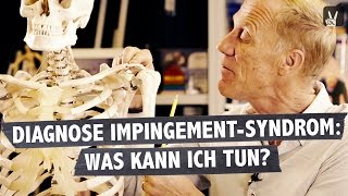 Impingement Syndrom  was ist passiert und was kann ich tun Professor Froböse klärt auf [upl. by Ppilihp]