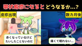 帯状疱疹になるとどうなるのか？症状や治療、予防について解説 【ずんだもん 医療 解説】 [upl. by Terencio]