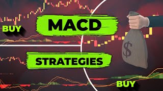 Ultimate MACD Trading Guide For Beginners Forex Crypto amp Stock MACD Strategies [upl. by Koziel404]