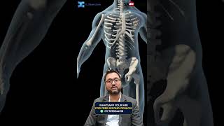 Treatment Options for Elbow Arthritis 🏥  Dr Debashish Chanda [upl. by John256]