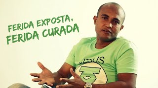 TAMO JUNTO  Atingindo o Alvo ferida exposta ferida curada [upl. by Akirdnuhs]