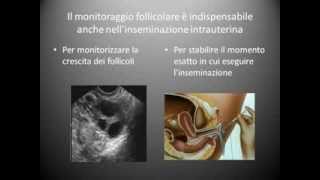 Monitoraggio dellovulazione  come funziona  Villa Salaria Hospital Roma You Tube [upl. by Calie]