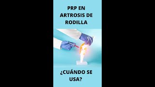 PRP EN ARTROSIS DE RODILLA ¿CUÁNDO USARLO Shorts prp artrosisderodilla [upl. by Stuppy]