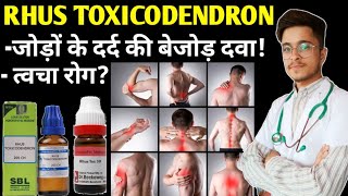 Rhus Tox 200 Homeopathic Medicine uses  Rhus Toxicodendron 30 uses in Hindi [upl. by Ateuqahs]