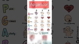 Apgarscor nidhigupta4338 explore shortsviral subscribers sortvideo [upl. by Opportina]