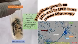 Penicillium growth on SDA and its LPCB tease mount Microscopy [upl. by Eanaj]