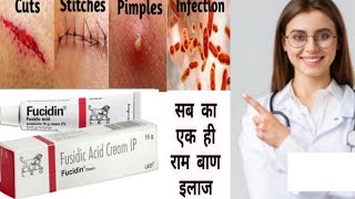 Fucidin Cream  Fucidic Acid Cream  ointment हिन्दी में Uses side effects  Honest review [upl. by Laamak822]