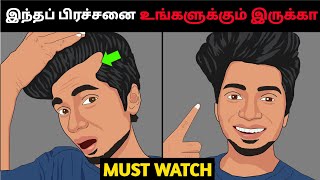 7 WAYS TO STOP HAIR FALL NATURALLY REGROW HAIR  HAIR FALL  Time For Greatness Tamil [upl. by Bard]