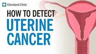 How Is Uterine Cancer Diagnosed [upl. by Schacker]