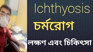 Ichthyosis চর্মরোগ কি [upl. by Eimmaj]