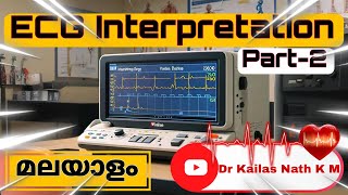 ECG Interpretation Made Easy in Malayalam  Part 2  aVR lead Heart Rate amp Rhythm [upl. by Pleione]