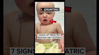 7 signs of pediatric respiratory distress emergency medicine ER medicalstudent parenting [upl. by Rhea]