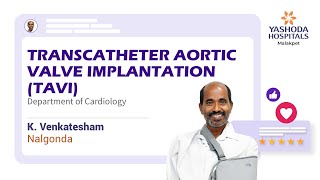 Transcatheter Aortic Valve Implantation TAVI  Yashoda Hospitals Hyderabad [upl. by Yecac184]