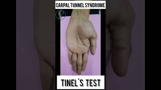 Tinels test for carpal tunnel syndrome physiotherapy carpaltunnalsyndrome physio viral yts [upl. by Ronni670]