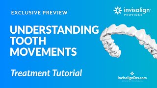 Understanding Invisalign Tooth Movements [upl. by Notxap]