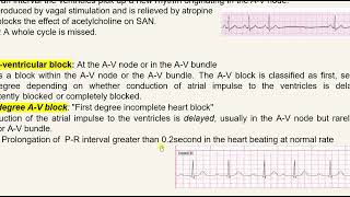 Lecture 7 Abnormal Ecg [upl. by Aloel]