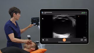 Ocular Ultrasound [upl. by Concordia]