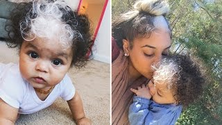 Baby Born With Unique White Streak Through Hair Just Like Her Mom [upl. by Laise]