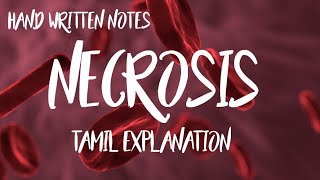 NECROSIS AND ITS TYPESTAMIL EXPLANATION HAND WRITTEN NOTES PATHOLOGY [upl. by Devona]