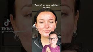 😨THE TRUTH ABOUT PIMPLE PATCHES What TikTok Doesnt Tell You shorts [upl. by Cornel899]