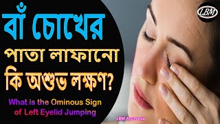 বাঁ চোখের পাতা লাফানো কি অশুভ লক্ষণ  What Is The Ominous Sign of Left Eyelid Twitching [upl. by Atalanta799]