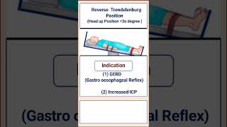 Reverse Trendelenburg Position [upl. by Dacy]