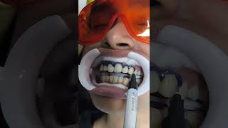 White teeth  Dontia Dental Care  Best Dental Clinic in Kolkata for teeth whitening dentist yt [upl. by Trudi]