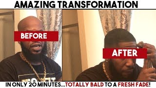 HOW TO GO FROM BALD TO HAVING HAIR IN MINUTES [upl. by Otineb4]