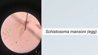 Trematodes Parasitology Practice Microscopic Identification [upl. by Oicirbaf]