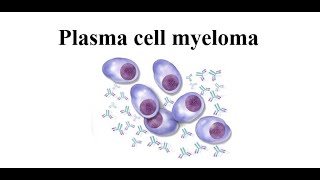 Plasma Cell Myeloma [upl. by Eem240]