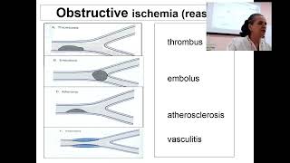 About Abnomality of periferal blood flow in 3 min Professor Maksimovich N Ye [upl. by Thill]