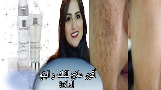 أفضل كريم و سيروم لعلاج الكلف و التصبغات  يساعد عل توحيد اللون pigmentclar la RochePosay [upl. by Mich]