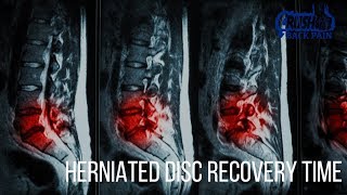 Herniated Disc Recovery Time [upl. by Prasad]