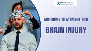 Exosome Treatment For Brain Injury  Brain Injury Treatment  Stem Cells  Neurological Disease [upl. by Neetsyrk405]