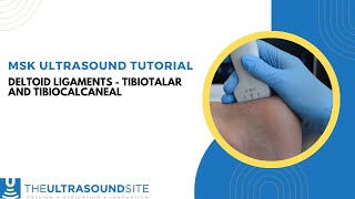 Musculoskeletal ultrasound evaluation of the ankle deltoid ligaments  tibiotalar  tibiocalcaneal [upl. by Rehpotsirhc398]