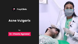 Acne Vulgaris  Dr Chesta Agrawal  Dermatology PrepClinic [upl. by Buonomo]