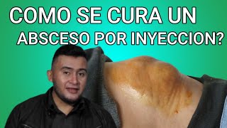 COMO se CURA un ABSCESO por INYECCION [upl. by Felty]