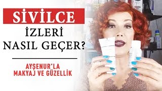 Sivilce İzleri Nasıl Geçer [upl. by Hasan]