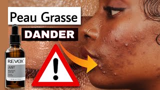 3 CONSEILS POUR PEAU GRASSE [upl. by Nosretep]