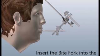 How to Transfer the Whip Mix Facebow from Patient to Articulator with the New Curved Bitefork [upl. by Pepper]