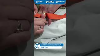 Cara Lepas Cincin Kekecilan di Jari [upl. by Yrailih]