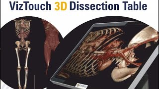 VizTouch 3D Dissection Table  Virtual Autopsy Solutions UK [upl. by Akinert228]