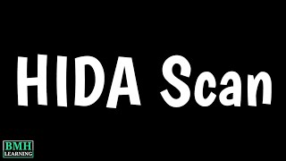 HIDA Scan Test  Cholescintigraphy  IDA Scan For Gallbladder  Hepatobiliary Scintigraphy [upl. by Bogie]